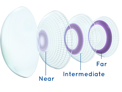 Best of Multifocal Lenses