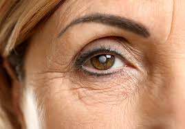 Causes Of Cataract