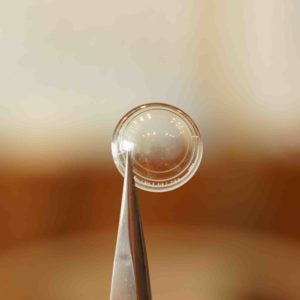 When The Contact Lens Needs To Be Removed