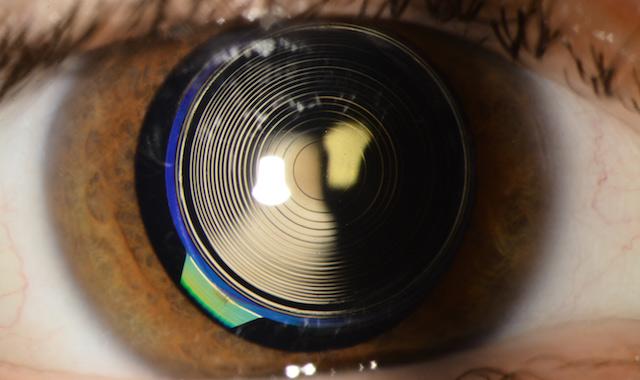 Things to know about Multifocal Lenses